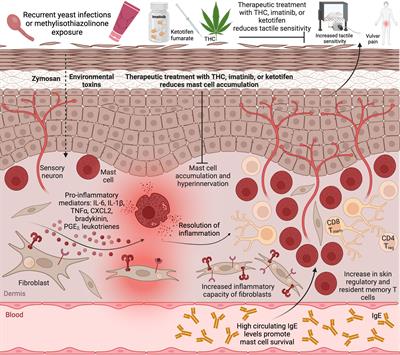Immune mechanisms in vulvodynia: key roles for mast cells and fibroblasts
